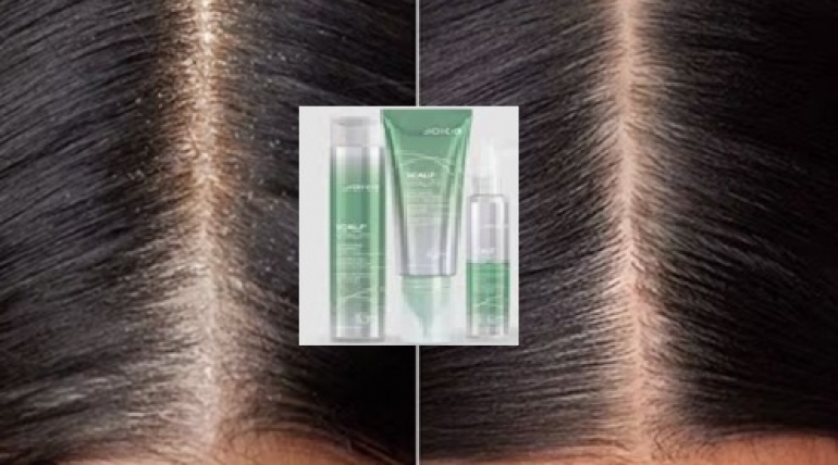 Joico Scalp Vitality- puhdistaa, kuorii ja kosteuttaa – tukien hiuspohjan suojakerrosta ja mikrobiomin tasapainoa